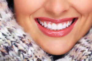 Beautiful woman smiling with her new dental implants
