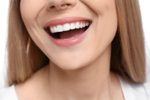 Woman with flawless smile following teeth straightening treatment in London