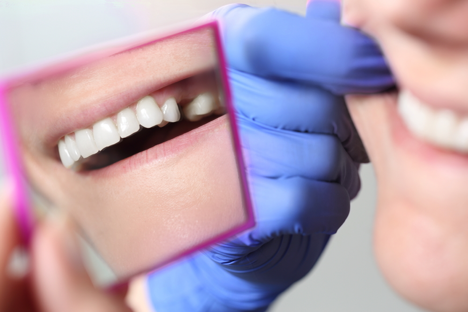 patient holding a mirror to their teeth