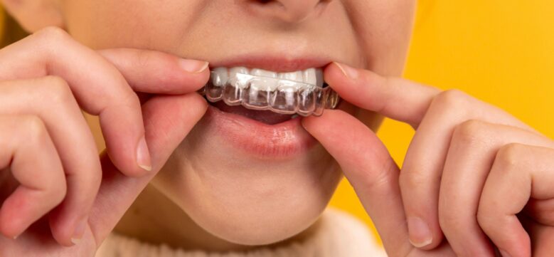 Blue Light Dental - Blog