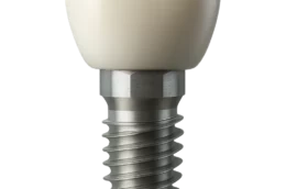 Dental implant procedure at Blue Light Dental Archway
